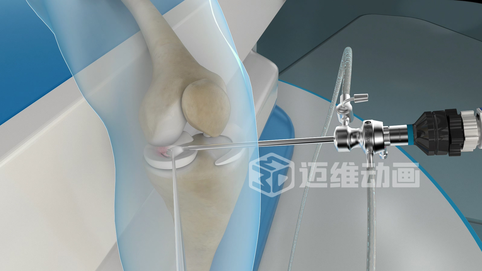 從 “看不懂” 到 “秒懂”，醫(yī)學(xué)醫(yī)療三維動畫憑什么兼顧專業(yè)度與傳播力？(圖1)