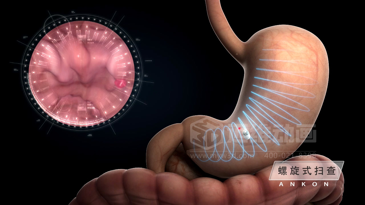 從 “看不懂” 到 “秒懂”，醫(yī)學(xué)醫(yī)療三維動畫憑什么兼顧專業(yè)度與傳播力？(圖5)